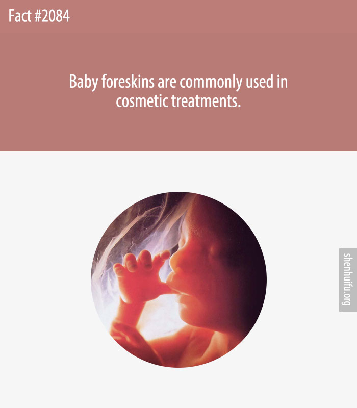 Baby foreskins are commonly used in cosmetic treatments.